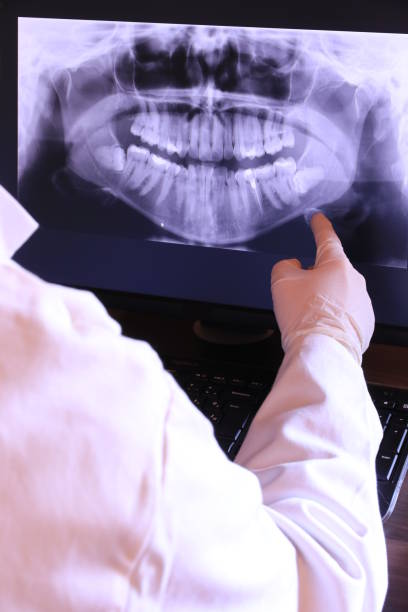 Best Emergency Dentist for Knocked-Out Tooth in Hollymead, VA