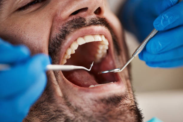 Best Emergency Root Canal Treatment in Hollymead, VA