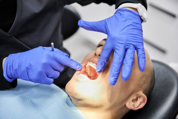 Best Broken or Cracked Tooth Emergency Dentist in Hollymead, VA